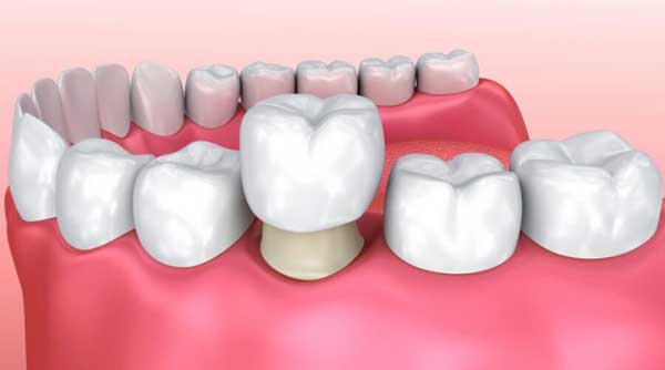 Rehabilitación Oral
